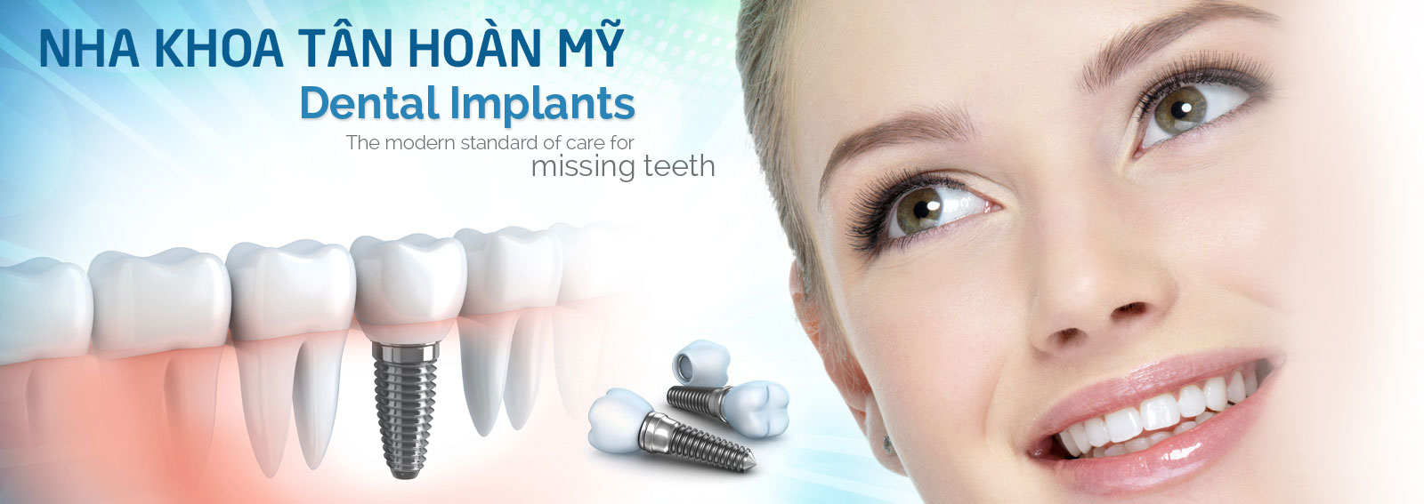 NHA KHOA TÂN HOÀN MỸ - Implants