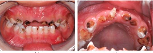 Những số liệu về chăm sóc sức khỏe răng miệng ở khu vực Đông Nam Á khiến chúng ta phải suy nghĩ!