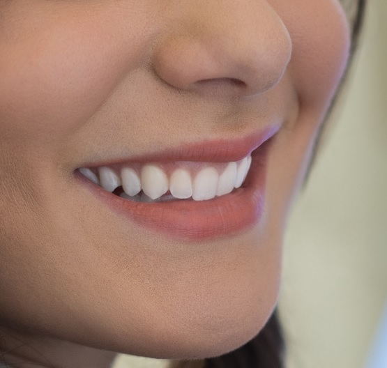 Chọn Bác sỹ chỉnh nha như thế nào để đạt kết quả như mong muốn? 