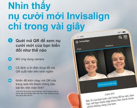 trai nghiem nu cuoi moi voi cua ban ung dung cua invisalign