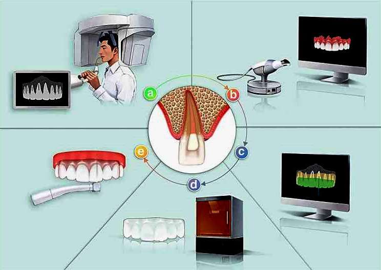 Điều trị tủy răng: Ứng dụng kỹ thuật số trong điều trị - Xu hướng của nha khoa chính xác