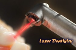 Nha khoa Tân Hoàn Mỹ - Laser trong điều trị nha khoa