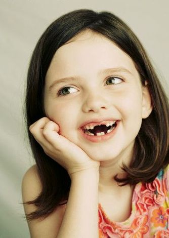 Những điều cần biết về điều trị chỉnh nha ở trẻ đang phát triển