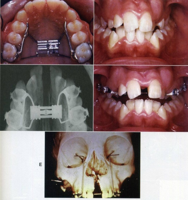 Làm đẹp cho “gốc con người”