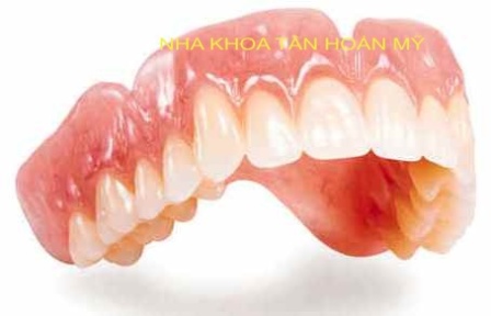 Tìm hiểu về Implant