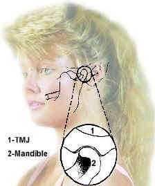 Các nguyên nhân và phương pháp điều trị rối loạn về khớp thái dương hàm
